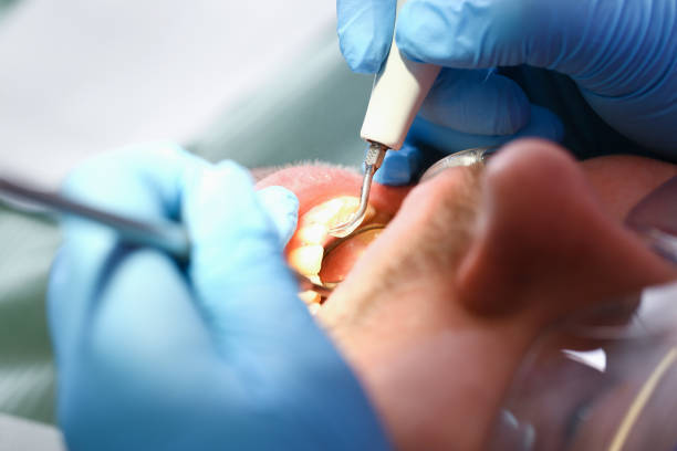 Best Urgent Care for Lost Fillings or Crowns in Whitesboro, TX