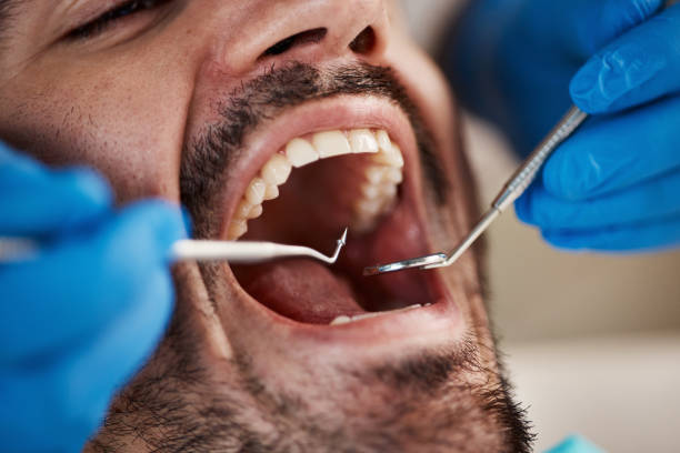 Best Emergency Tooth Extraction in Whitesboro, TX